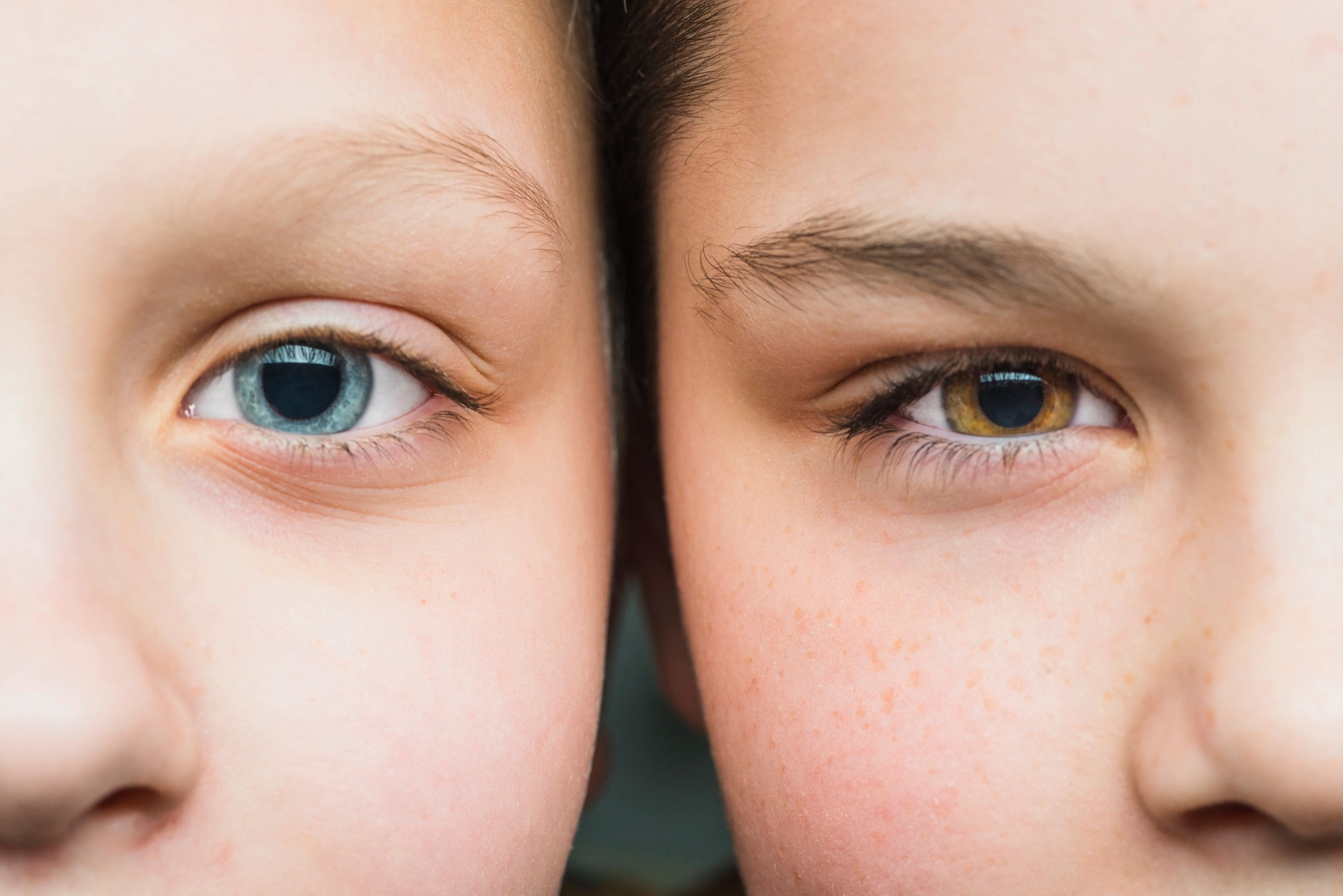 Cirugía LASIK Miopía Cuauhtémoc CDMX