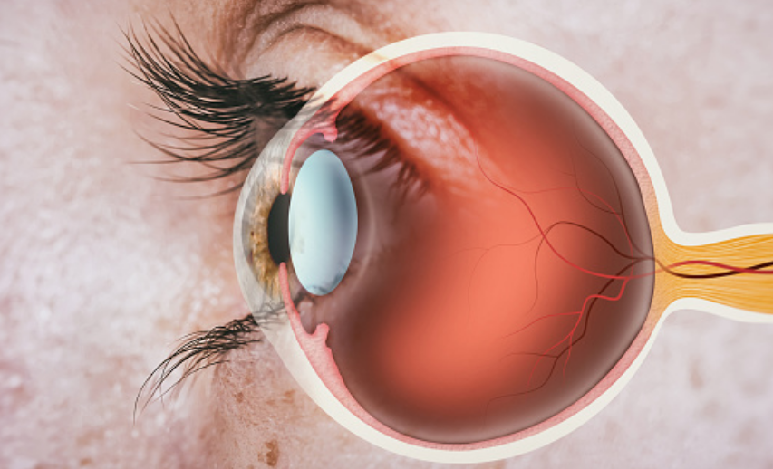 Cirugía Vitreorretiniana: ¿Qué es, para qué sirve y dónde se realiza?