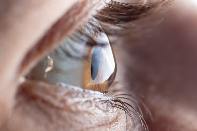 Córnea gruesa: ¿Qué es y cuáles son los riesgos?